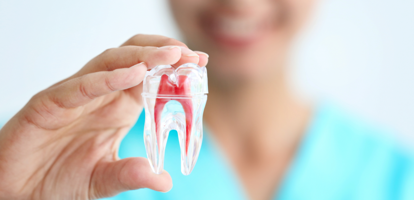 After your root canal procedure