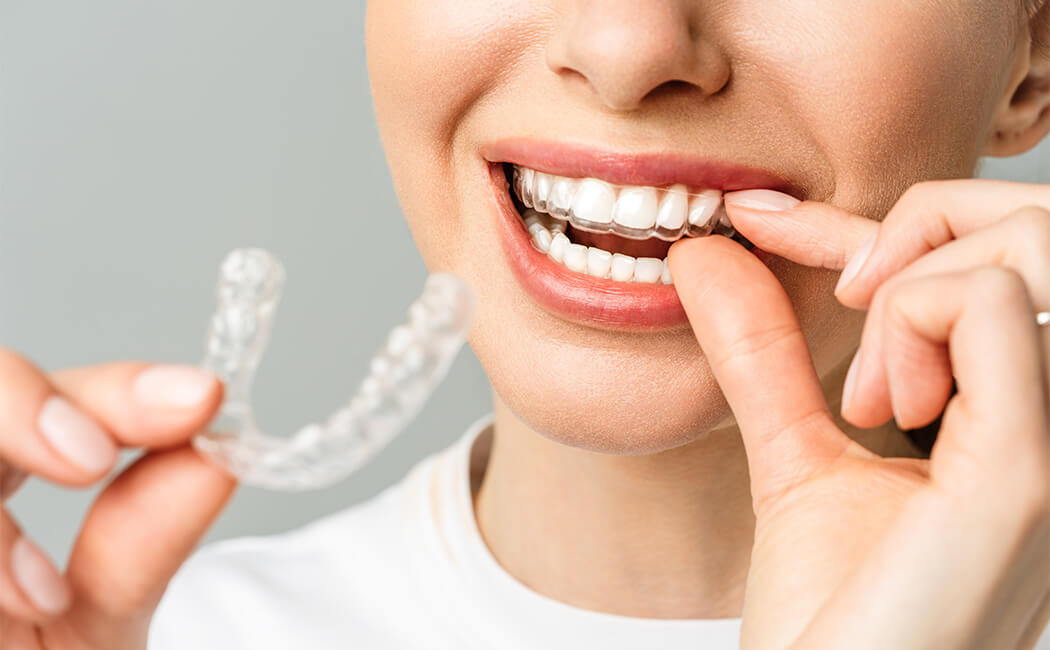 Tips to Maintain the Durability of Dental Crown