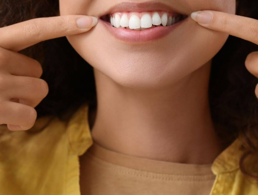 From Chips to Gaps: How Dental Veneers Can Fix Your Teeth Imperfections